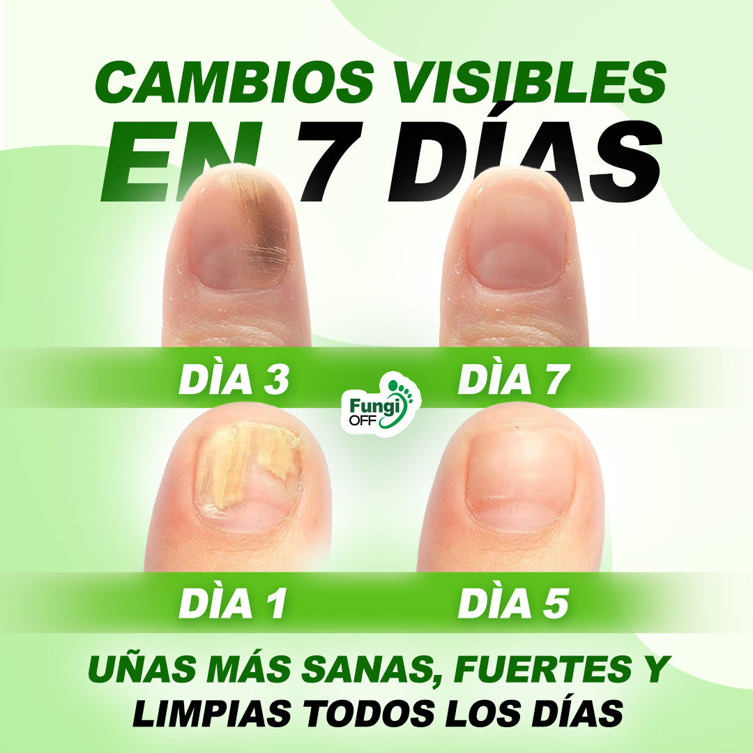 Spray FungiOff Acaba con los Hongos en 7 Días | LLEVA 3 PAGA 1